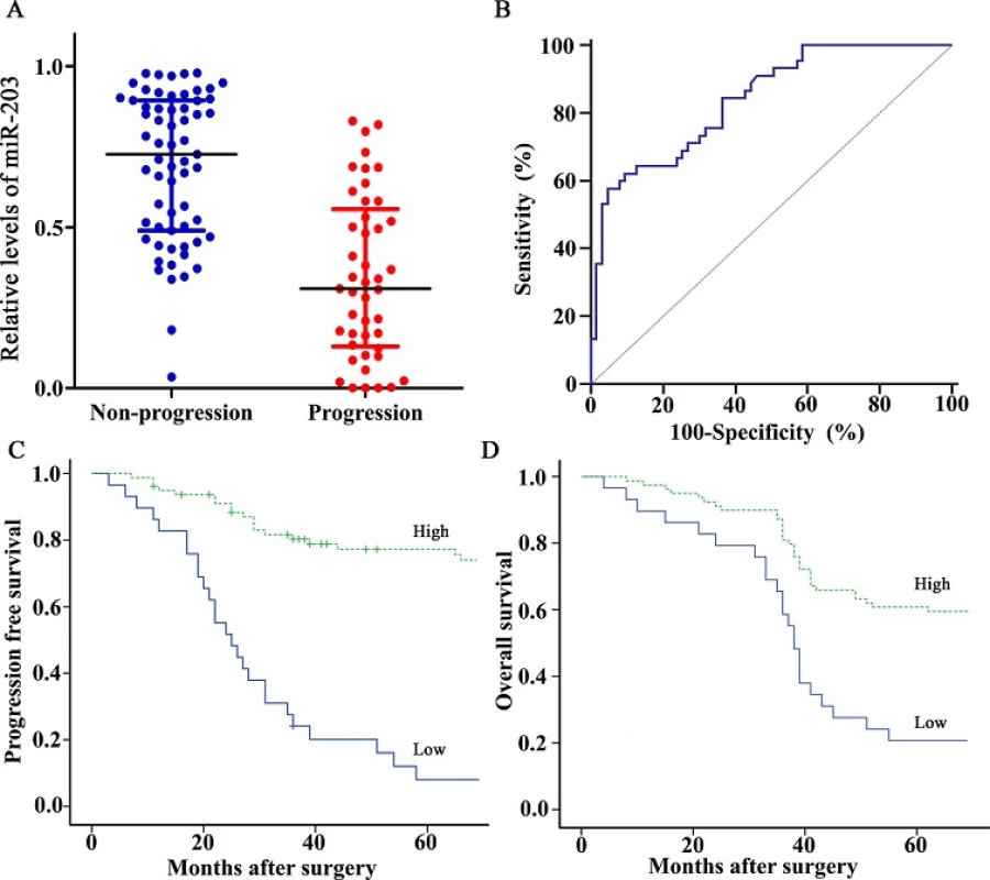 Expression and prognosis of miR-203 for bladder cancer patients treated with cisplatin-based chemotherapy. (A) miR-203 levels were detected by RT-qPCR method and normalized against U6 RNA in 108 cases of bladder cancer tissues. Levels of miR-203 in progression group were significantly lower than those in non-progression group (P<0.001, Mann-Whitney U test). (B) ROC curve distinguished patients with progression from those
without progression using miR-203, with an area under the ROC curve value of 0.839 (95% CI, 0.756–0.903). (C, D) Kaplan-Meier PFS and OS curves based on miR-203 expression of bladder cancer patients. The optimal cut off value (0.345) calculated by ROC analysis was used to classify the patients as high and low miR-203 expression groups. Low expression of miR-203 was significantly correlated with shortened PFS or OS (Both P<0.001, log-rank test).