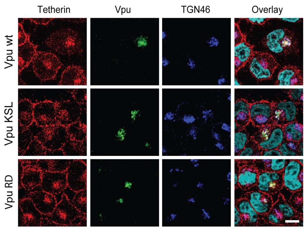 Re-localization of Tetherin in the TGN requires the association of Vpu to the restriction factor.