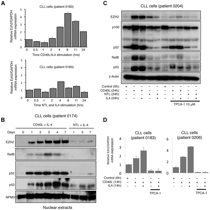 CD40 stimulation leads to NF-κB activation and CLL induction in Chronic Lymphocytic Leukemia cells.