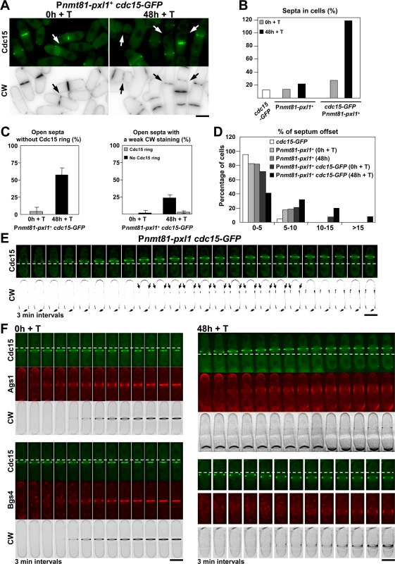 A joint reduction of Cdc15 and Pxl1 functions induces severe CAR sliding and causes septum material deposition along the plasma membrane.