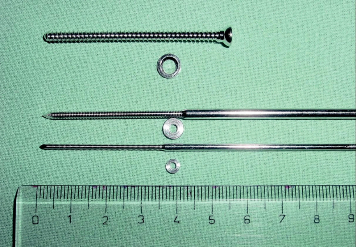 Používaný osteosyntetický materiál, 3,5mm kanalyzované šrouby, fragment fixační systém(FFS).