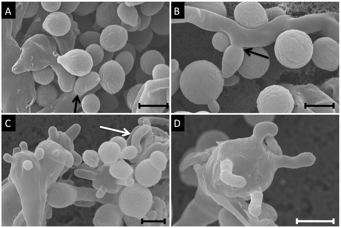Scanning electron microscopy imaging of two VGIIIb isolates undergoing a-α mating to produce spores.