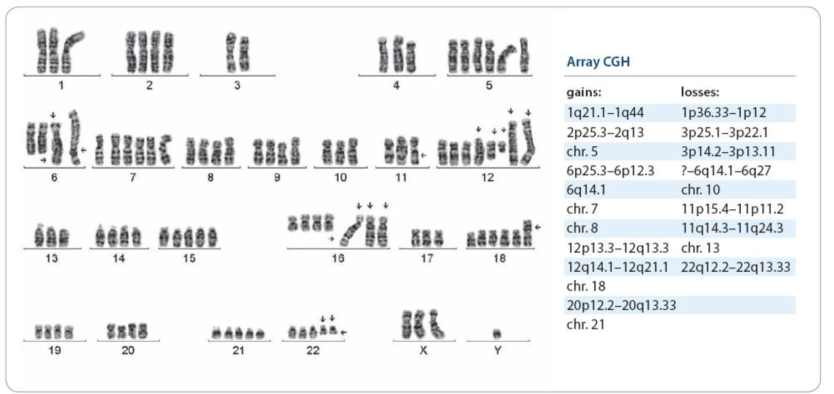 Pacient s generalizovaným ES malé pánve, cytogenetické a arrayCGH vyšetření provedeno při 1. relapsu, nyní po 2. relapsu do plic, LU mediastina a dutiny břišní. Karyotyp s indikátory negativní prognózy: s mnohočetnými změnami, o modálním počtu 55~100, der(16)t(1;16)(q21;q13)×3.