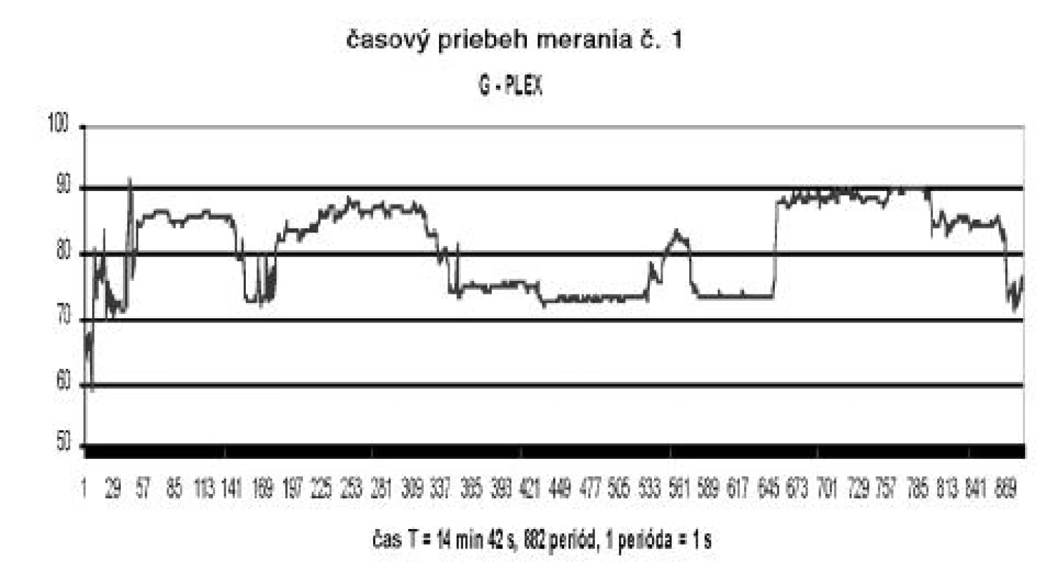 Ukážka originálneho grafického zápisu priebehu merania kosačky značky G-PLEX