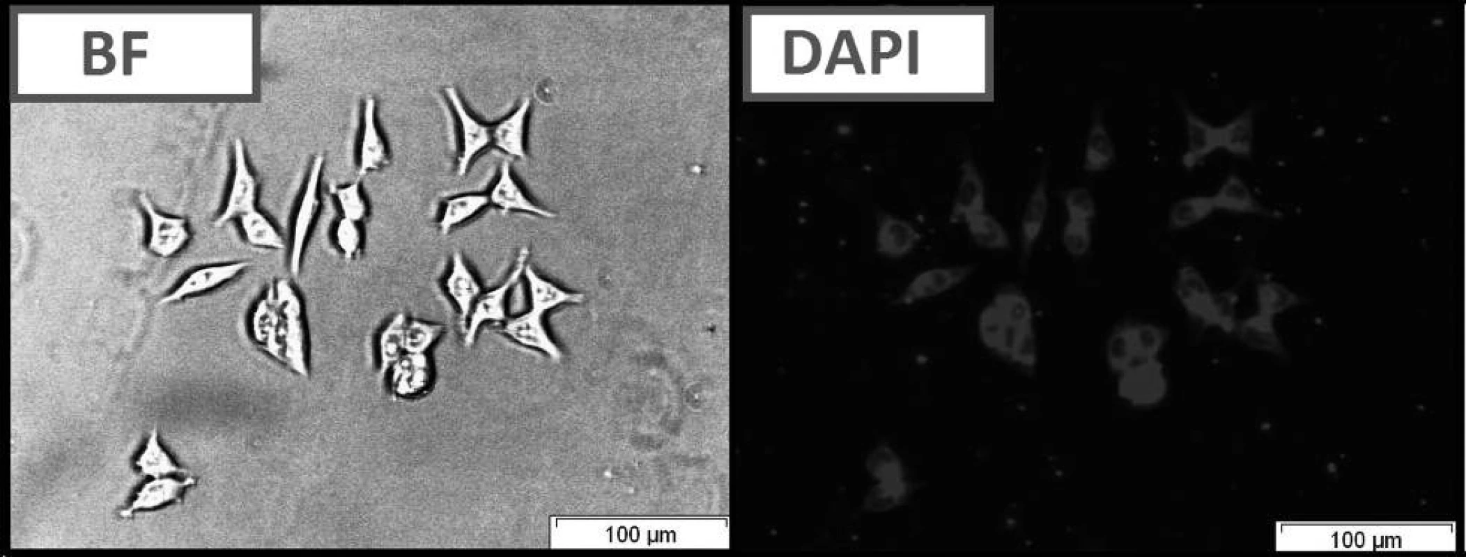 Live cell imaging of HCT116 cells following treatment with compound C using bright field optical microscopy (BF) and fluorescence microscopy (DAPI filter).