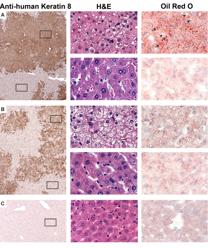 Histopathology of FIAU-induced liver toxicity in TK-NOG mice with humanized livers.