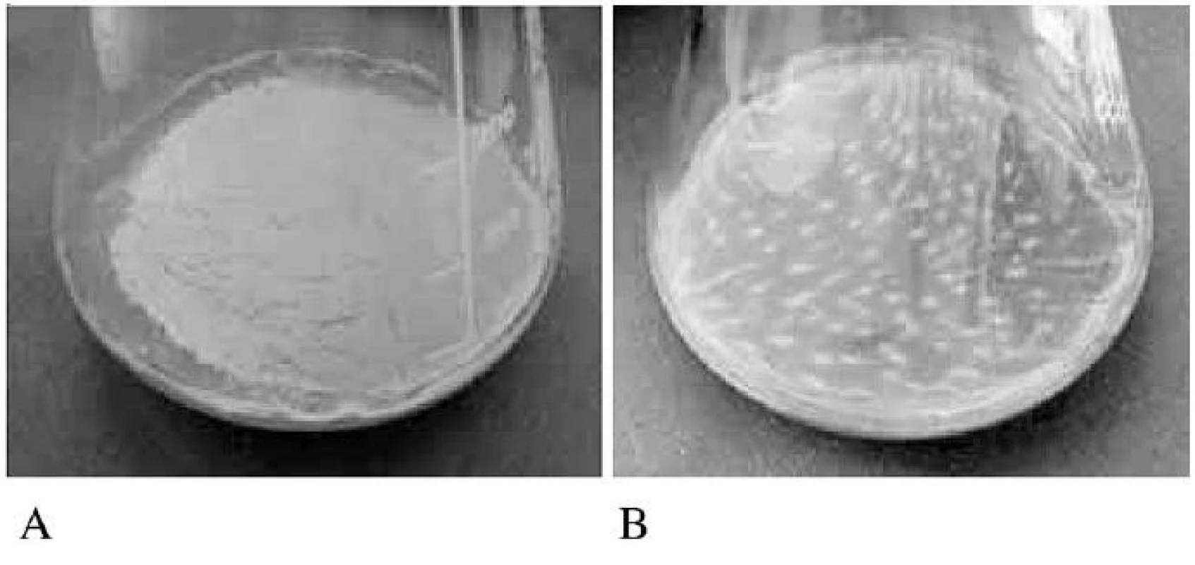 Aerovaný biofilm
A – kompaktní typ, B – vločkovitý typ

Fig. 3. Formation of aerated biofilm
A – compact biofilm, B – floccular biofilm