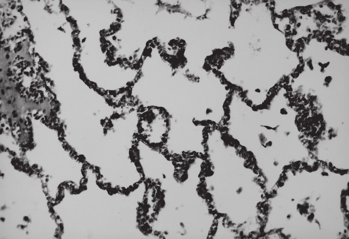 Mikroskopický obraz pľúcneho tkaniva pred evakuáciou alveolárneho vzduchu; HE, 200x.