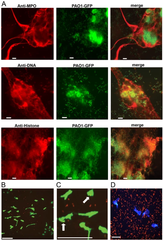 <i>P. aeruginosa</i> PAO1 is trapped by human and mouse neutrophil extracellular traps.