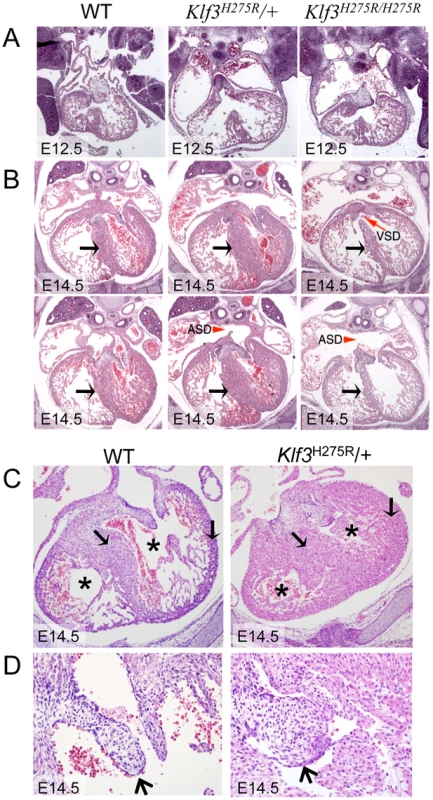Abnormal cardiac histology in <i>Klf3<sup>H275R</sup></i> embryos.