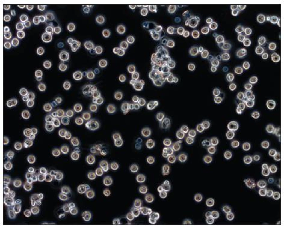 Soubor makrofágů v mikroskopu s fázovým kontrastem
Fig. 1. Population of macrophages in a phase contrast microscope