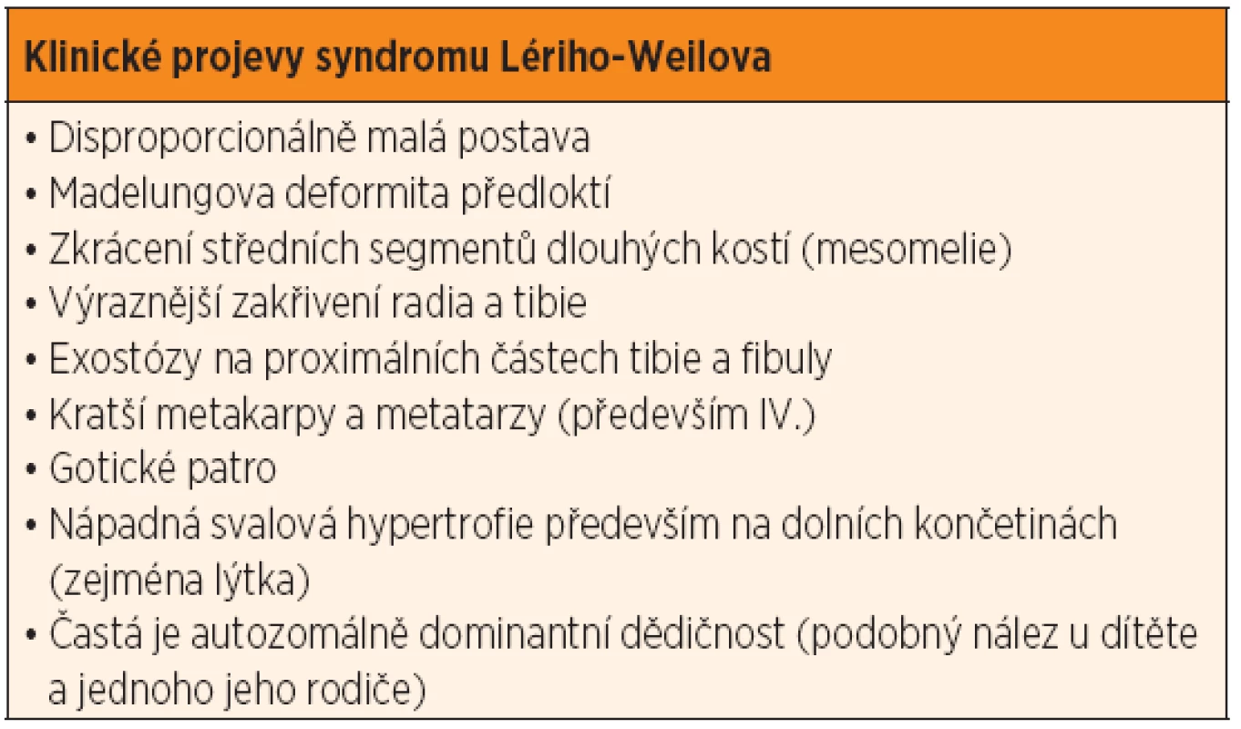 Klinické projevy syndromu Lériho-Weilova (porucha genu SHOX).
