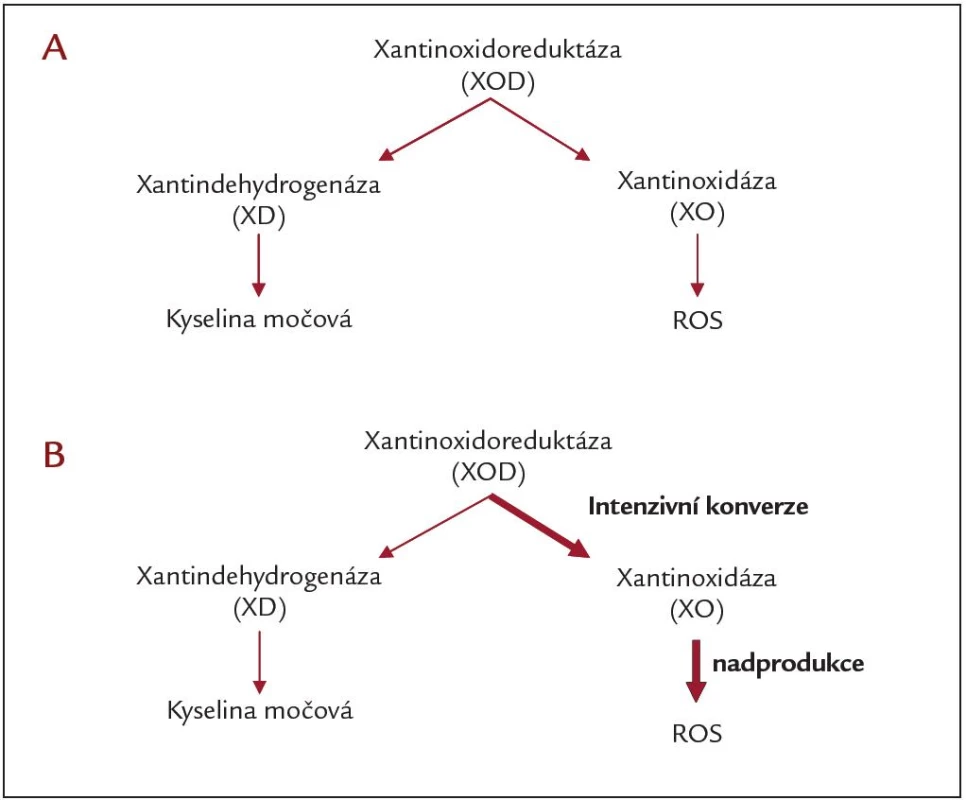 Konverze xantinoxidoreduktázy: A) za normálních podmínek a B) v průběhu ischemie/reperfuze.