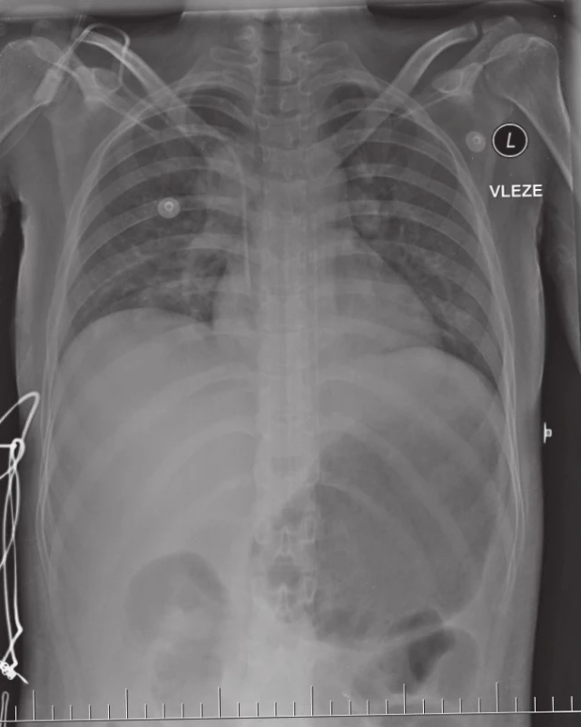 Snímek pacientky z případu č. 2 po příhodě.