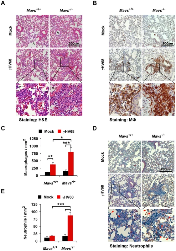 Loss of MAVS increases immune cell infiltration in the lung of γHV68-infected mice.