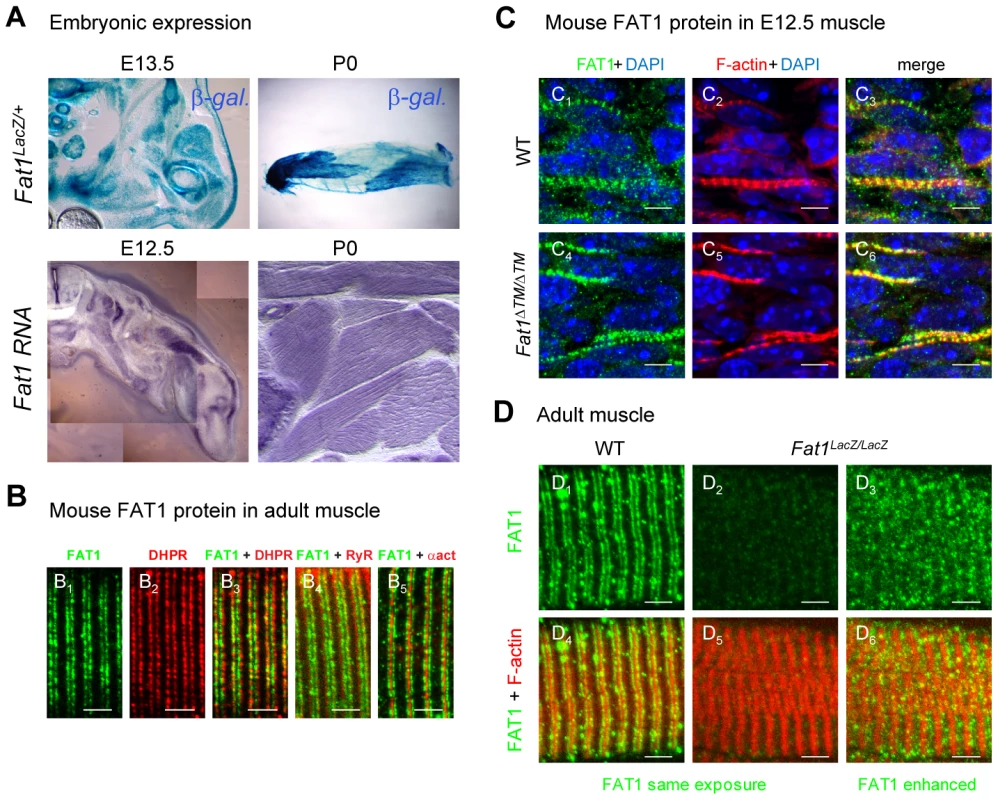 <i>Fat1</i> expression at late stages of muscle differentiation.