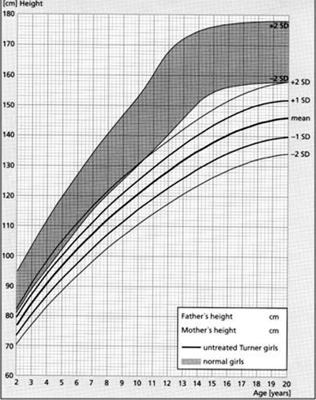 Růstový graf neléčených dívek s Turnerovýmsyndromem ve srovnání se zdravou dívčí populací (šedé pásmo) podle Rankeho (1983). Růstová retardace se u dívek s Turnerovým syndromem rozvíjí již od dětství a výrazně se prohlubuje v dospívání. Bez léčby dosahuje mladá žena s Turnerovým syndromem dospělé výšky v průměru 146 cm (s rozmezím od 134 do 158 cm).