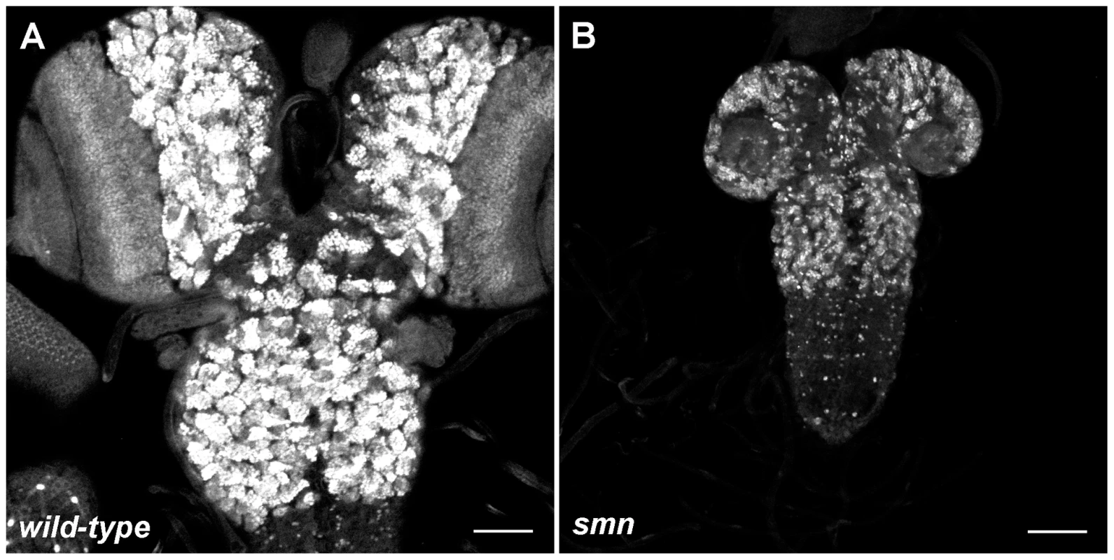 Growth defects in the SMN mutant CNS.