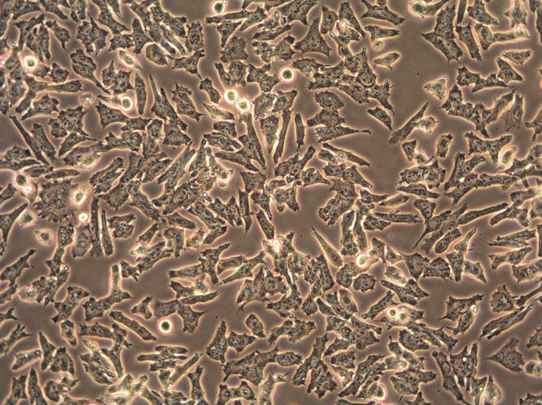 Obrázek z inverzního mikroskopu pořízený ve fázovém kontrastu v průběhu kultivace neuroblastomové buněčné linie UKF-NB-4 (originální zvětšení 200x).