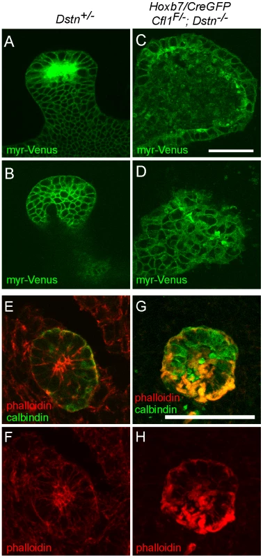 Disruption of actin depolymerization results in irregular ureteric epithelial cell shape and organization due to F-actin accumulation in <i>Cfl;Dstn</i> double mutant ureteric bud.