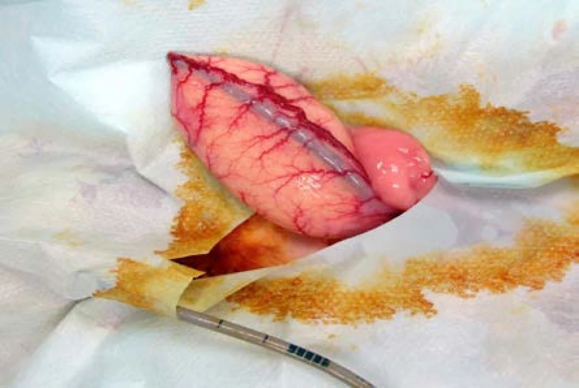 Peroperační snímek močového měchýře králíka, zaveden cystometrický katétr
Fig. 2. Intraoperative photo of rabbit bladder, with inserted cystometric catheter