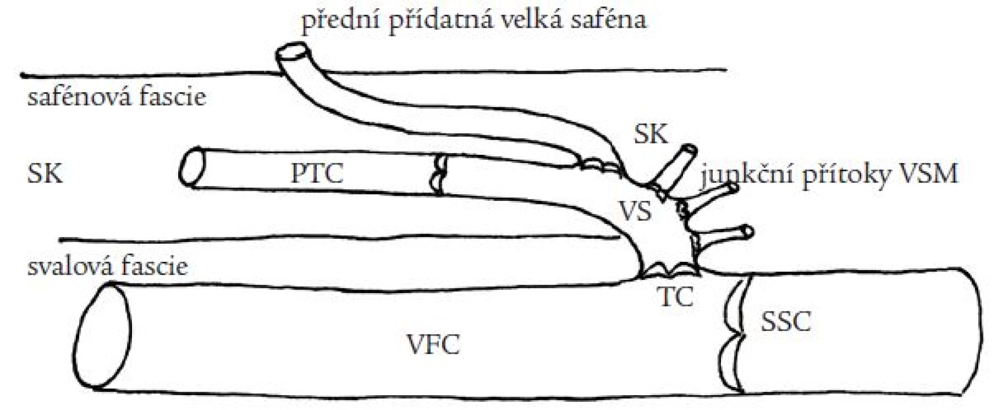 Anatomie přední přídatné velké safény (PPVS). PPVS odstupuje z velké safény v různé vzdálenosti od terminální chlopně (TC), probíhá v safénovém kompartmentu (SK) ohraničeném safénovou a svalovou fascií, v různé vzdálenosti od svého odstupu z VS proráží safénovou fascii do povrchnějších částí podkoží.