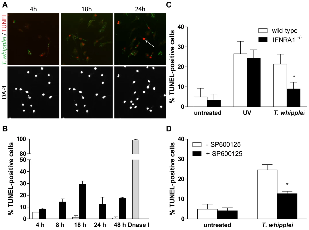 <i>T. whipplei</i>-induced apoptosis depends on type I IFN through JNK activity.