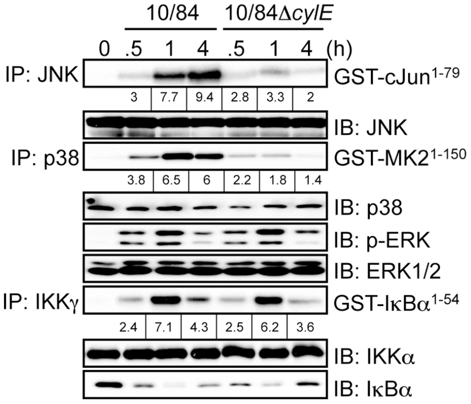 βh/c increases JNK and p38 MAPK activation in GBS infected macrophages.