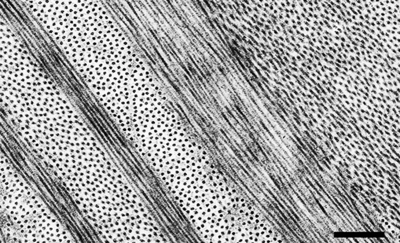 Elektronová transmisní mikroskopie stromatu rohovky zdravého dárce zobrazující kolagenní lamely tvořené pravidelně uspořádanými fibrilami ležícími v úhlu 0–90°. Příčný řez rohovkou, měřítko 500 nm (poskytnuto Dr. R. D.Youngem, Dept. of Optometry &amp; Vision Sciences, Cardiff University, Velká Británie)