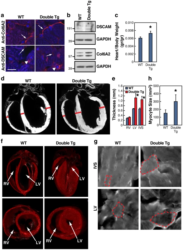 DSCAM and COL6A2 double transgenic mice exhibit cardiac hypertrophy.