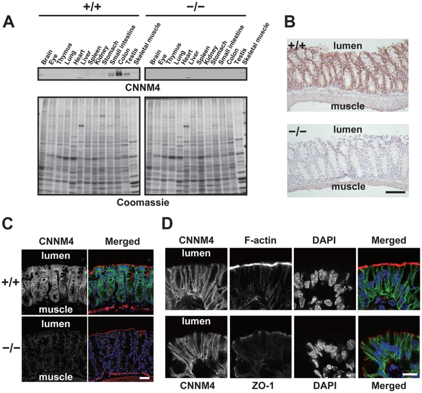 Basolateral localization of CNNM4 in the intestinal epithelia.