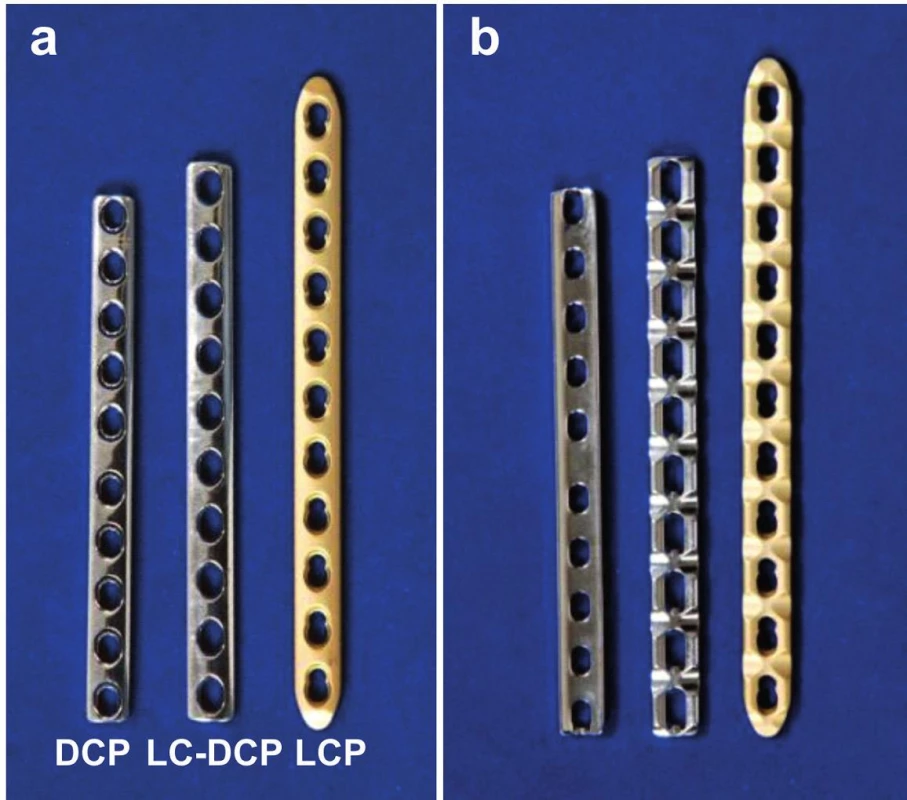 Dlahy pro diafyzární zlomeniny předloktí: a – zevní plocha dlahy; b – vnitřní plocha dlahy; DCP – standardní dynamická kompresní dlaha 3.5 mm, LC DCP – dynamická kompresní dlaha 3.5 mm se sníženým kontaktem, LCP – zamykací dlaha 3.5 mm. DCP dlaha je vzhledem k vyžlabení svého kostního (vnitřního) povrchu ideálním implantátem k aplikaci na laterální plochu diafýzy radia. Další výhodou dlahy je její snadná tvarovatelnost a menší šířka než u LC DCP a LCP dlah.
Fig. 1: Plates for diaphyseal fractures of forearm: a – external surface of plates; b – internal surface of plates; DCP – standard dynamic compression plate 3.5mm, LC DCP – low contact dynamic compression plate 3.5mm, LCP – locking plate 3.5mm. Thanks to its concave profile of the inner (bone contact) surface, DCP plate is an ideal implant for placement on the lateral surface of the radial shaft. Another advantage is that the plate can be easily shaped and is less wide than LC DCP and LCP plates.