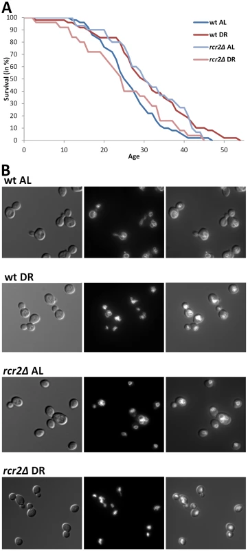 DR–essential vacuole-associated genes are required for DR lifespan extension and normal vacuolar morphology.