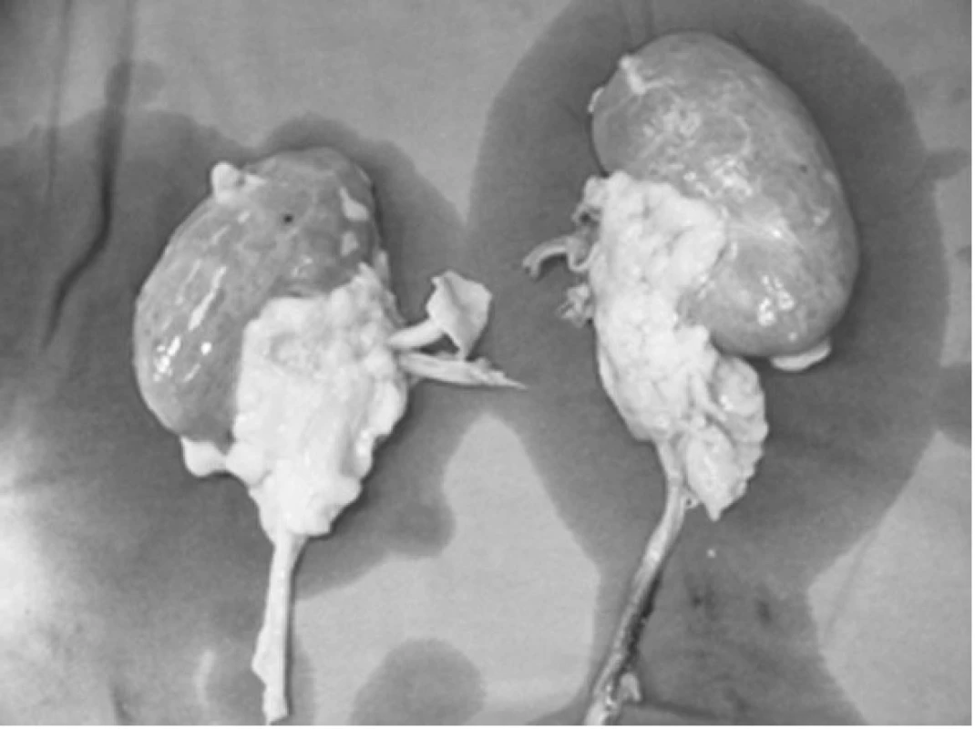 Odebrané ledvinné štěpy
Fig. 2. Collected kidney grafts