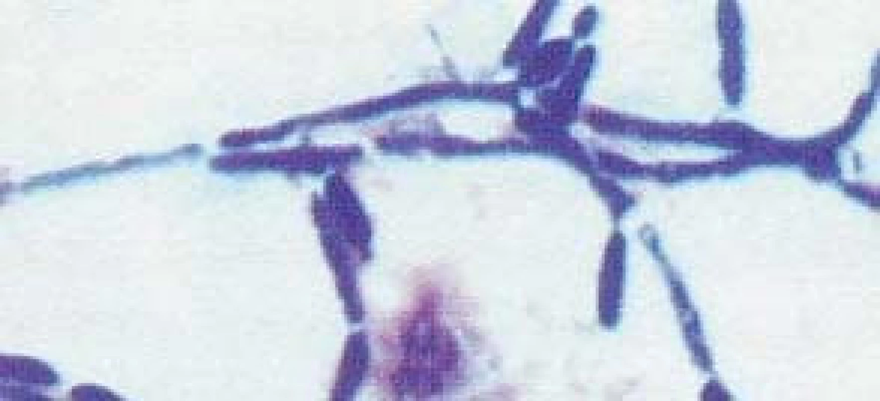 Candida albicans, vláknitá forma (hyfy).