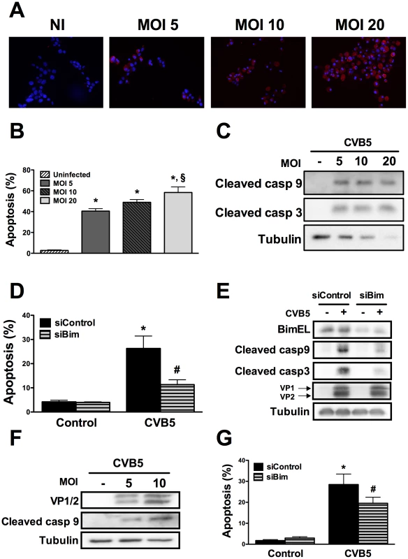 CVB5 infection induces apoptosis in beta cells via the BH3-only protein Bim.
