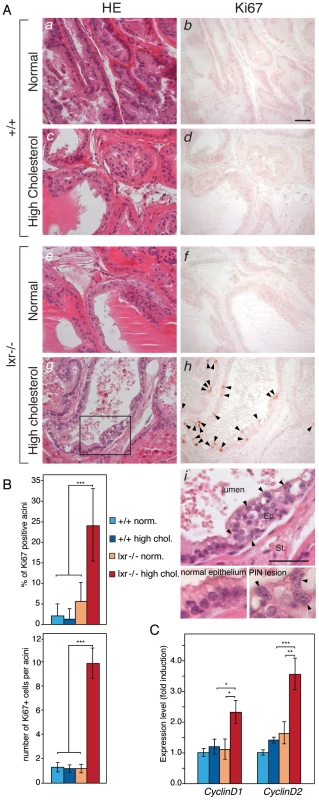High-cholesterol diet induces proliferation in LXR mutant mouse prostate.