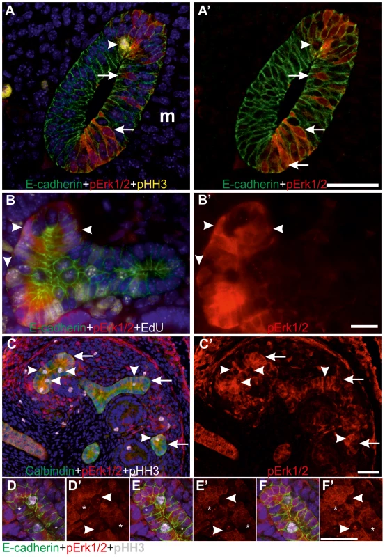 MAPK co-localizes with G1/S-phase markers in the ureteric bud epithelial cells.
