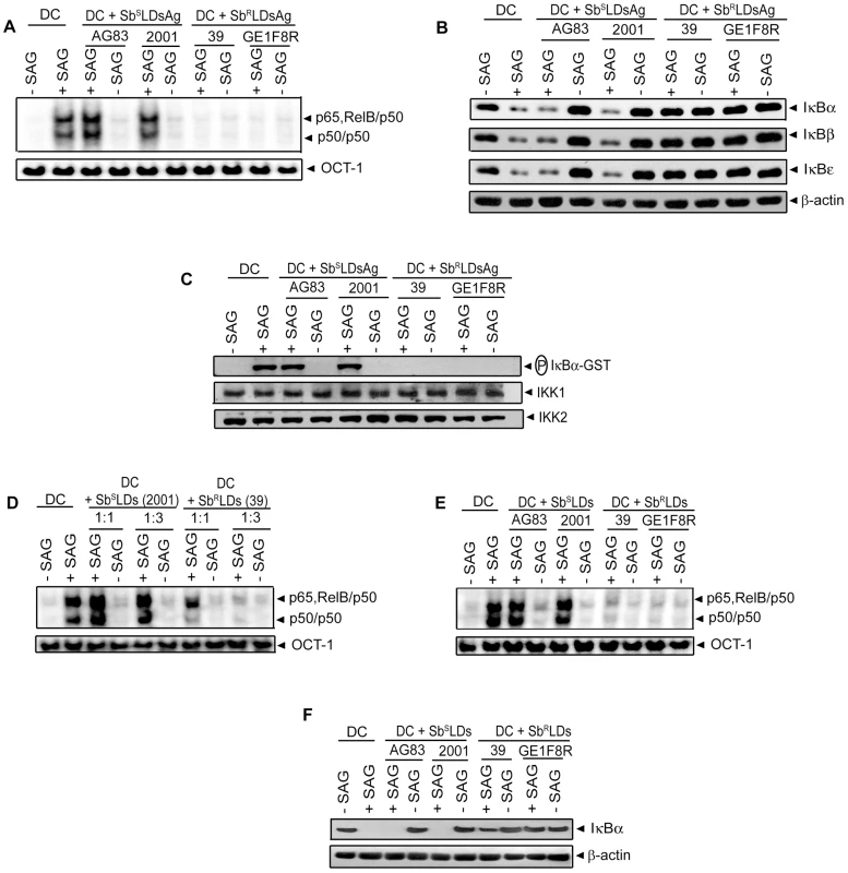 DC pretreatment with antigens or culture supernatant of Sb<sup>R</sup>LD inhibits SAG-induced NF-κB pathway.