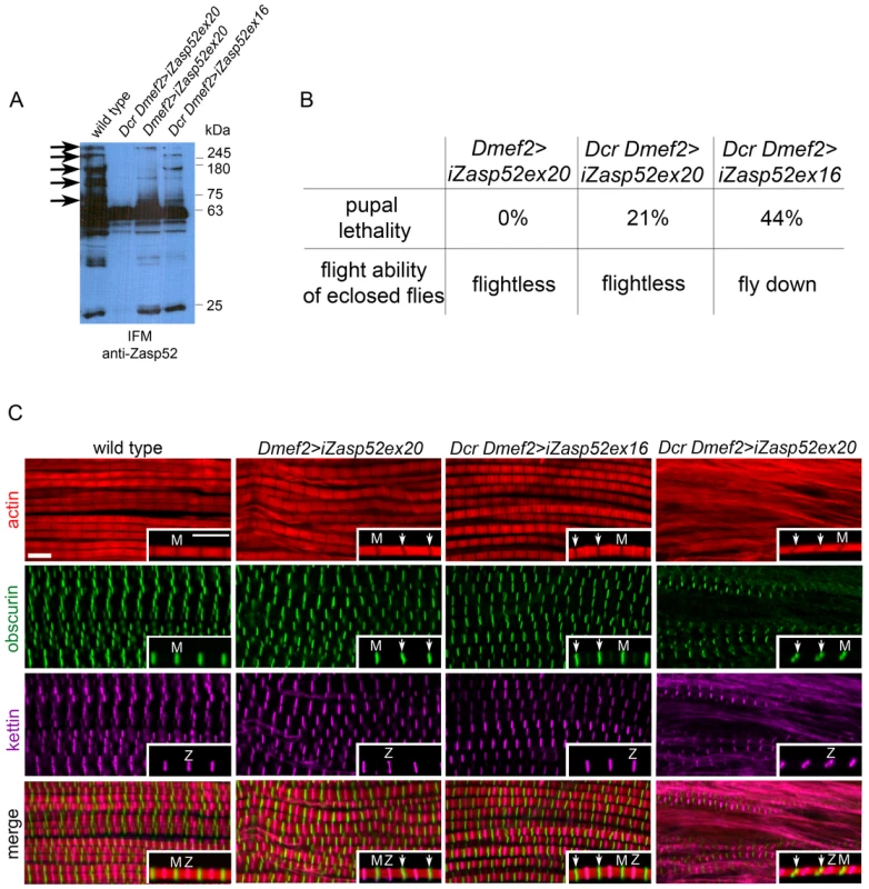 Depleting long isoforms of Zasp52 affects IFM structure.