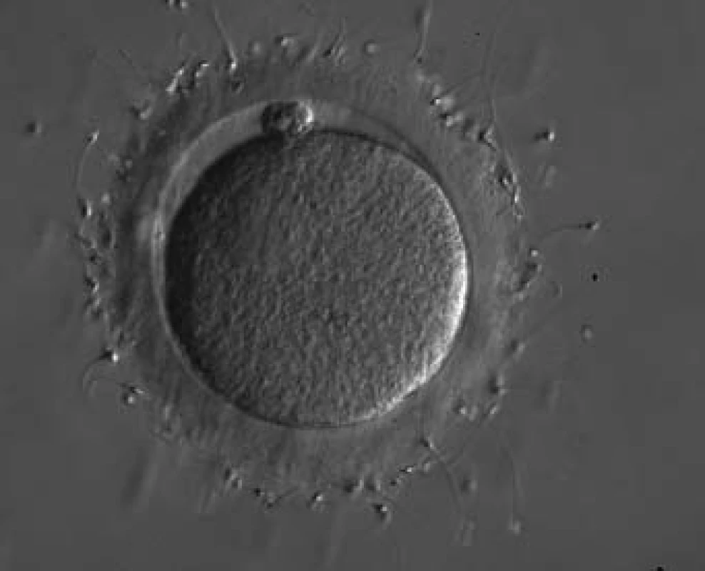 Spermie navázané na zona pellucida oocytu - standardní IVF.