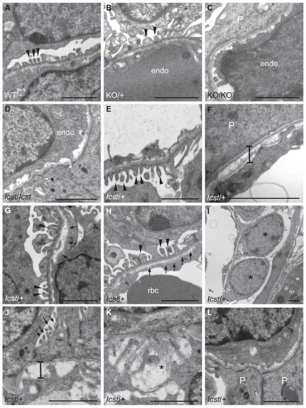 Ultrastructural analysis of E17.5 and E18.5 kidneys shows that <i>Icst</i> causes glomerular defects when heterozygous.