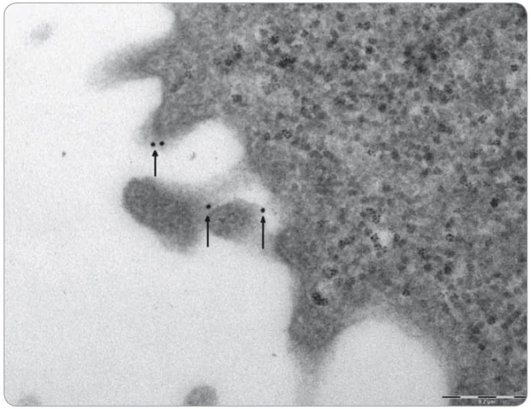 Snímek z transmisního elektronového mikroskopu (s laskavostí prof. MUDr. Drahomíra Horkého, DrSc.) zobrazující část buňky SU-DHL4 (linie maligního B lymfomu). Nanočástice zlata vázané systémem biotin-avidin na monoklonální protilátku anti-CD20 zobrazují místa exprese antigenu CD20 na membráně buňky (viz šipky).