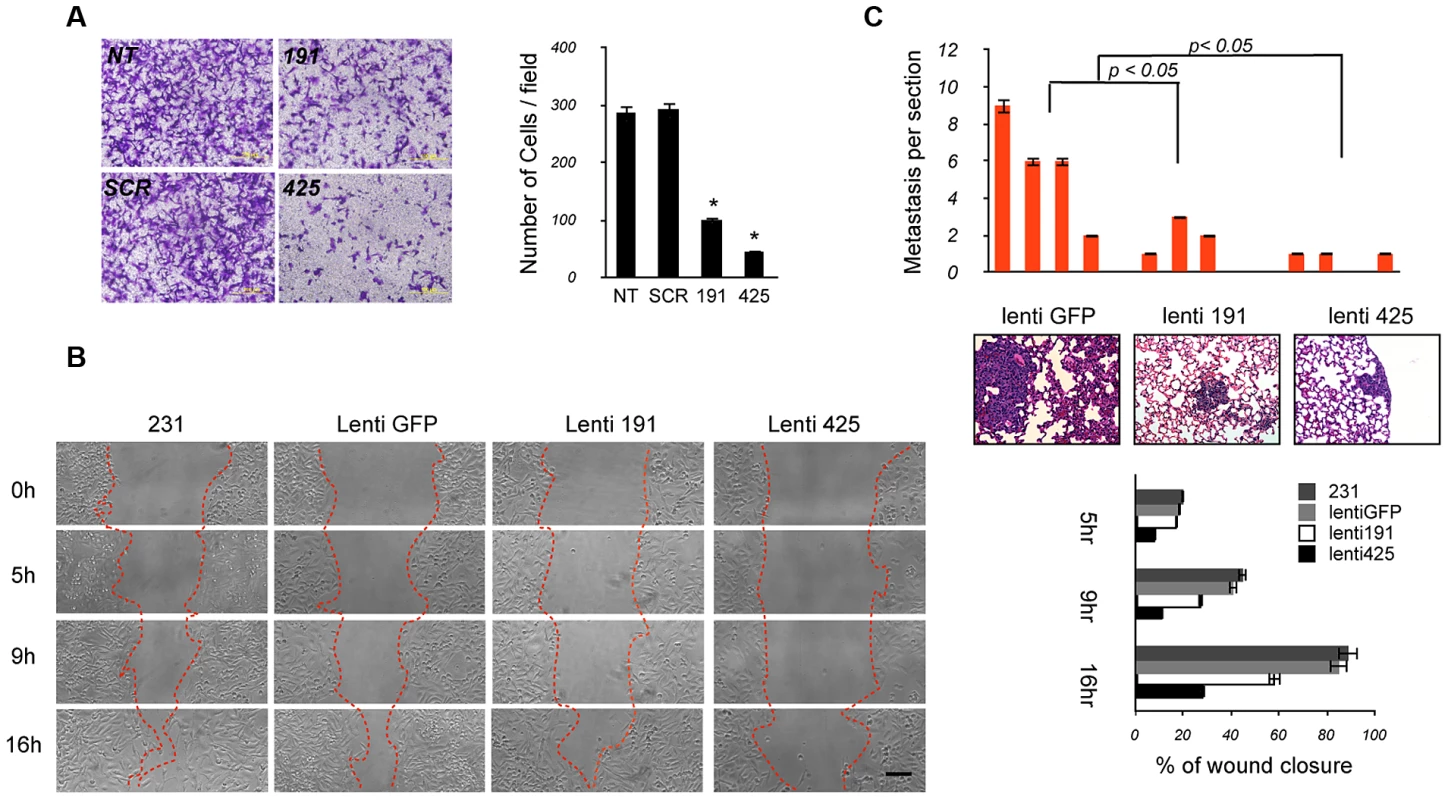 The miR-191/425 cluster reduces migration and metastatic dissemination of breast cancer cells.