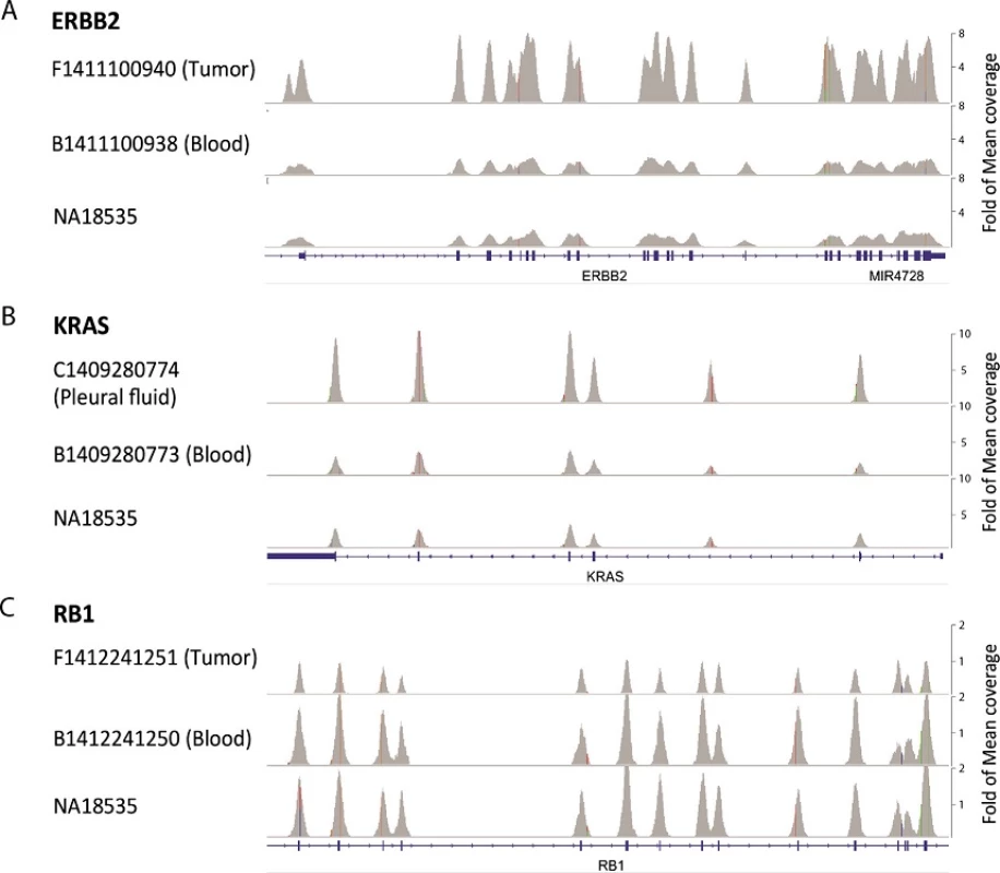 Examples of copy number variations (CNVs) identified by next-generation sequencing (NGS). Sequence alignment data of ERBB2 (A), KRAS (B) and RB1 (C) was viewed by Integrative Genomics Viewer (IGV). Matched blood sample and NA18535 DNA was served as control. RefSeq Gene track was shown at the bottom. Due to the difference in coverage depth, samples are presented at the same fold of mean coverage depth for all matching and normal control samples as labeled on the right.