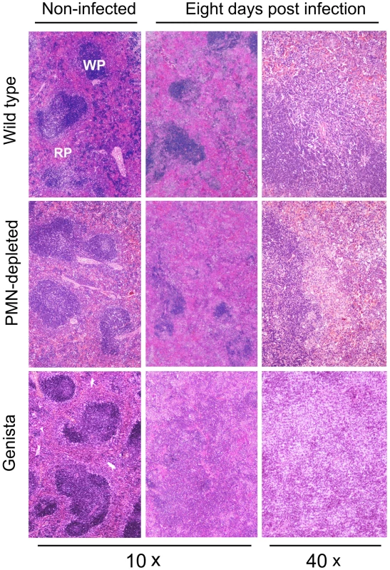 Lymphoid depletion, macrophage infiltration and granuloma formation becomes more prominent in spleens of PMN-depleted and Genista than in WT <i>Brucella</i> infected mice.