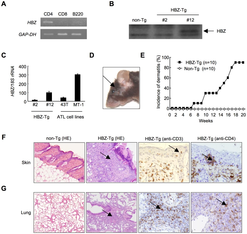 <i>HBZ</i>-Tg mice spontaneously develop inflammatory diseases in skin and lung.