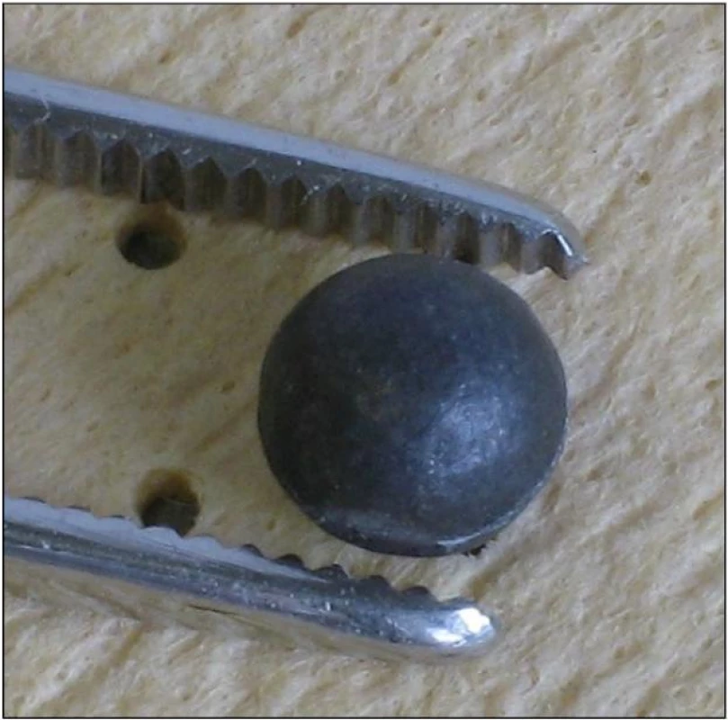 Sférická střela 6 mm  – brok: uchopení dvoučelisťovým nástrojem je vždy nestabilní