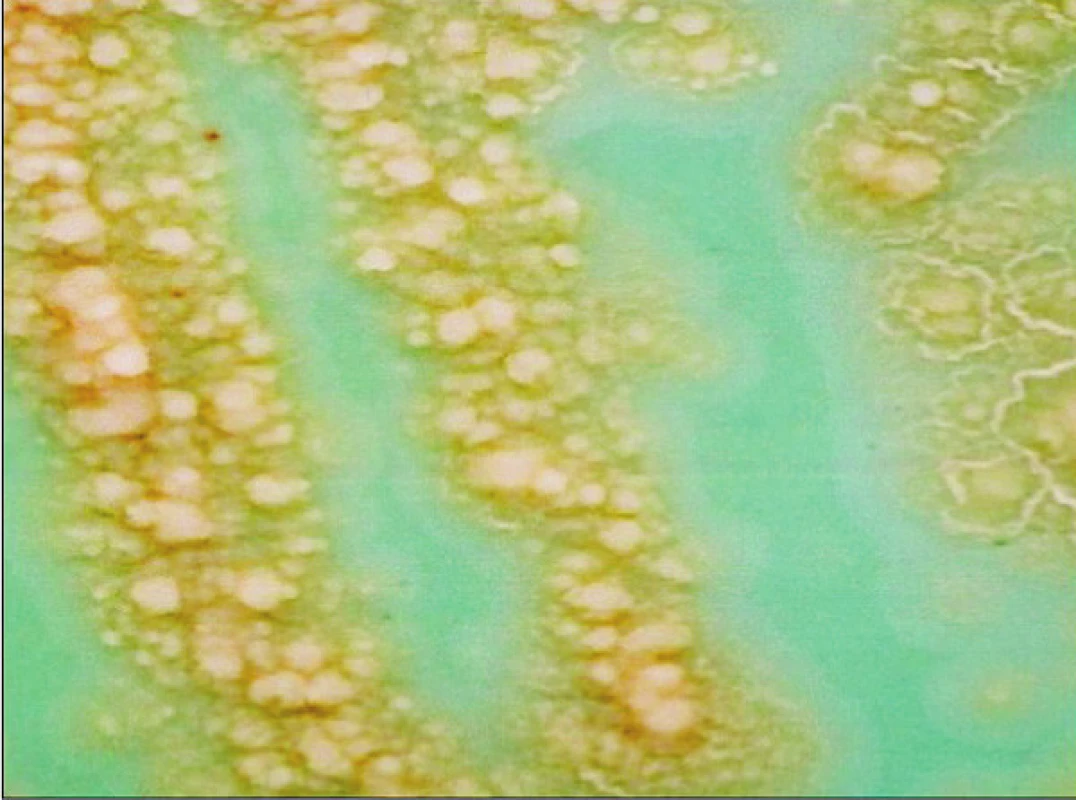 Kolonie &lt;i&gt;Mycobacterium tuberculosis&lt;/i&gt; na Ogawově kultivační půdě
