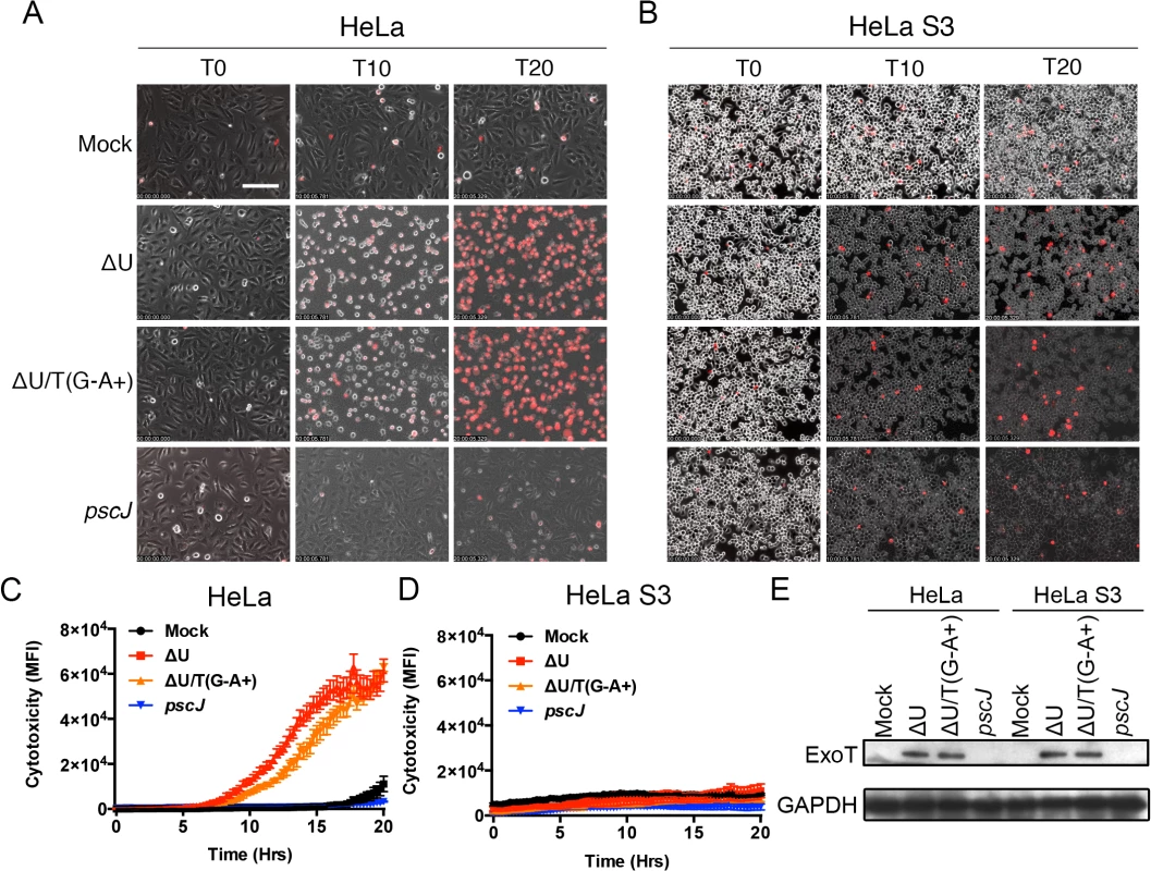 Anoikis resistant HeLa S3 cells are resistant to ExoT/ADPRT-induced cytotoxicity.